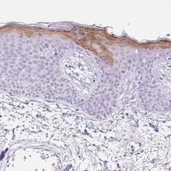 Invitrogen SPRR4 Polyclonal Antibody 100 &mu;L; Unconjugated:Antibodies,