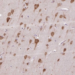 Invitrogen HABP4 Polyclonal Antibody 100 &mu;L; Unconjugated:Antibodies,