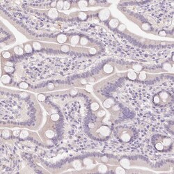 Invitrogen HABP4 Polyclonal Antibody 100 &mu;L; Unconjugated:Antibodies,