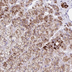 Invitrogen ANKRD9 Polyclonal Antibody 100 &mu;L; Unconjugated:Antibodies,