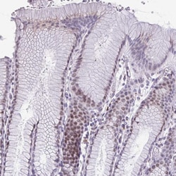 Invitrogen ZNF682 Polyclonal Antibody 100 &mu;L; Unconjugated:Antibodies,