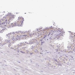 Invitrogen HEXB Polyclonal Antibody 100 &mu;L; Unconjugated:Antibodies,