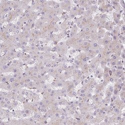 Invitrogen HEXB Polyclonal Antibody 100 &mu;L; Unconjugated:Antibodies,