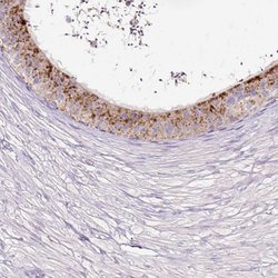 Invitrogen HEXB Polyclonal Antibody 100 &mu;L; Unconjugated:Antibodies,