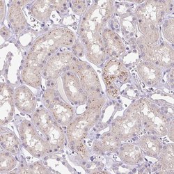 Invitrogen HEXB Polyclonal Antibody 100 &mu;L; Unconjugated:Antibodies,