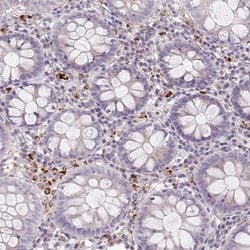 Invitrogen HEXB Polyclonal Antibody 100 &mu;L; Unconjugated:Antibodies,