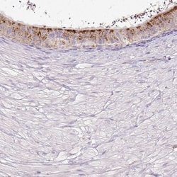 Invitrogen HEXB Polyclonal Antibody 100 &mu;L; Unconjugated:Antibodies,