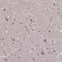 Invitrogen DIP2B Polyclonal Antibody 100 &mu;L; Unconjugated:Antibodies,