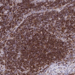 Invitrogen ERI1 Polyclonal Antibody 100 &mu;L; Unconjugated:Antibodies,