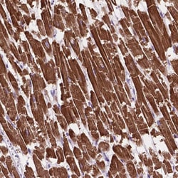 Invitrogen MBTPS1 Polyclonal Antibody 100 &mu;L; Unconjugated:Antibodies,