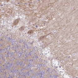 Invitrogen RASL10A Polyclonal Antibody 100 &mu;L; Unconjugated:Antibodies,