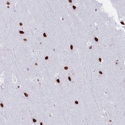 Invitrogen DDX52 Polyclonal Antibody 100 &mu;L; Unconjugated:Antibodies,