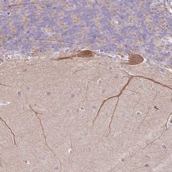 Invitrogen NDST3 Polyclonal Antibody 100 &mu;L | Buy Online | Invitrogen&trade; | Fisher Scientific