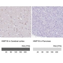 Invitrogen NSG2 Polyclonal Antibody 100 &mu;L; Unconjugated:Antibodies,