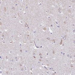 Invitrogen NSG2 Polyclonal Antibody 100 &mu;L; Unconjugated:Antibodies,