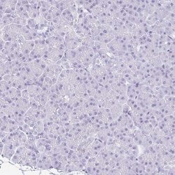 Invitrogen NSG2 Polyclonal Antibody 100 &mu;L; Unconjugated:Antibodies,