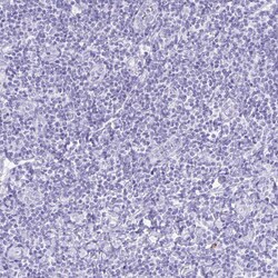 Invitrogen NSG2 Polyclonal Antibody 100 &mu;L; Unconjugated:Antibodies,
