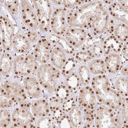 Invitrogen GLTSCR1 Polyclonal Antibody 100 &mu;L; Unconjugated:Antibodies,