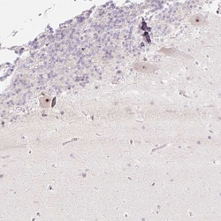 Invitrogen ZNF417 Polyclonal Antibody 100 &mu;L; Unconjugated:Antibodies,