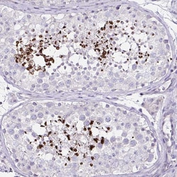 Invitrogen D2HGDH Polyclonal Antibody 100 &mu;L; Unconjugated:Antibodies,