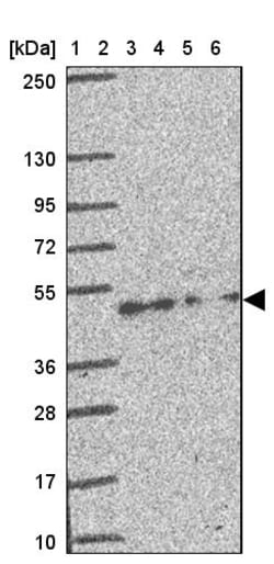 Invitrogen CREB3L3 Polyclonal Antibody 100 &mu;L; Unconjugated:Antibodies,