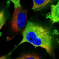 Invitrogen AKAP12 Polyclonal Antibody 100 &mu;L; Unconjugated:Antibodies,