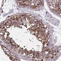 Invitrogen AKAP12 Polyclonal Antibody 100 &mu;L; Unconjugated:Antibodies,