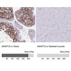Invitrogen AKAP12 Polyclonal Antibody 100 &mu;L; Unconjugated:Antibodies,