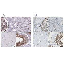 Invitrogen AKAP12 Polyclonal Antibody 100 &mu;L; Unconjugated:Antibodies,