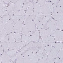 Invitrogen AKAP12 Polyclonal Antibody 100 &mu;L; Unconjugated:Antibodies,