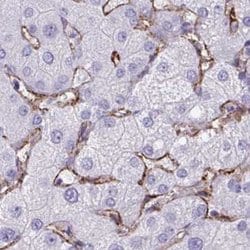 Invitrogen AKAP12 Polyclonal Antibody 100 &mu;L; Unconjugated:Antibodies,