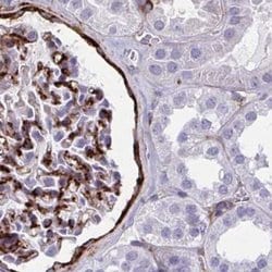 Invitrogen AKAP12 Polyclonal Antibody 100 &mu;L; Unconjugated:Antibodies,
