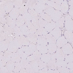 Invitrogen™ GRID2 Polyclonal Antibody