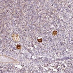 Invitrogen NALP5 Polyclonal Antibody 100 &mu;L; Unconjugated:Antibodies,