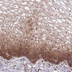 Invitrogen Septin-10 Polyclonal Antibody 100 &mu;L | Buy Online | Invitrogen&trade; | Fisher Scientific