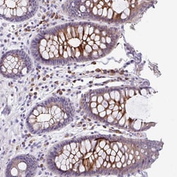 Invitrogen LRRC26 Polyclonal Antibody 100 &mu;L; Unconjugated:Antibodies,