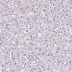Invitrogen LRRC26 Polyclonal Antibody 100 &mu;L; Unconjugated:Antibodies,