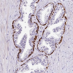 Invitrogen LRRC26 Polyclonal Antibody 100 &mu;L; Unconjugated:Antibodies,