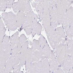 Invitrogen CDH19 Polyclonal Antibody 100 &mu;L; Unconjugated:Antibodies,