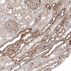Invitrogen KLHL24 Polyclonal Antibody 100 &mu;L; Unconjugated:Antibodies,
