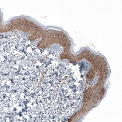 Invitrogen KLHL24 Polyclonal Antibody 100 &mu;L; Unconjugated:Antibodies,