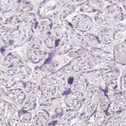 Invitrogen CYP11B1 Polyclonal Antibody 100 &mu;L; Unconjugated:Antibodies,