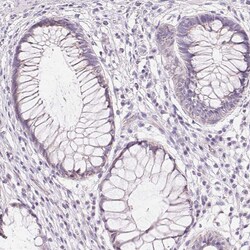 Invitrogen CYP11B1 Polyclonal Antibody 100 &mu;L; Unconjugated:Antibodies,