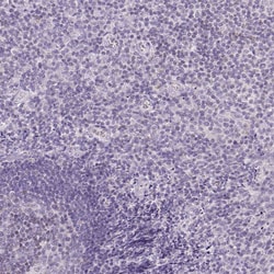 Invitrogen CYP11B1 Polyclonal Antibody 100 &mu;L; Unconjugated:Antibodies,