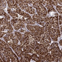 Invitrogen CYP11B1 Polyclonal Antibody 100 &mu;L; Unconjugated:Antibodies,