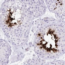 Invitrogen PRM2 Polyclonal Antibody 100 &mu;L | Buy Online | Invitrogen&trade; | Fisher Scientific