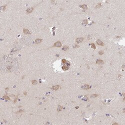 Invitrogen TMEM229A Polyclonal Antibody 100 &mu;L; Unconjugated:Antibodies,
