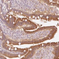 Invitrogen HEBP1 Polyclonal Antibody 100 &mu;L; Unconjugated:Antibodies,