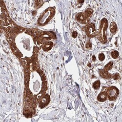 Invitrogen BTF3 Polyclonal Antibody 100 &mu;L; Unconjugated:Antibodies,