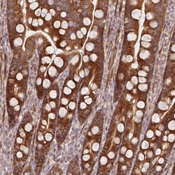 Invitrogen BTF3 Polyclonal Antibody 100 &mu;L; Unconjugated:Antibodies